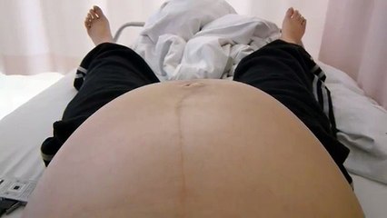 胎児【妊娠35週ﾍﾞﾋﾞｰお腹の中で赤ちゃんしゃっくり中♡】baby hiccups in belly