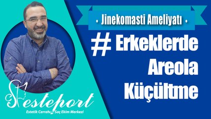 Erkeklerde Areola Küçültme