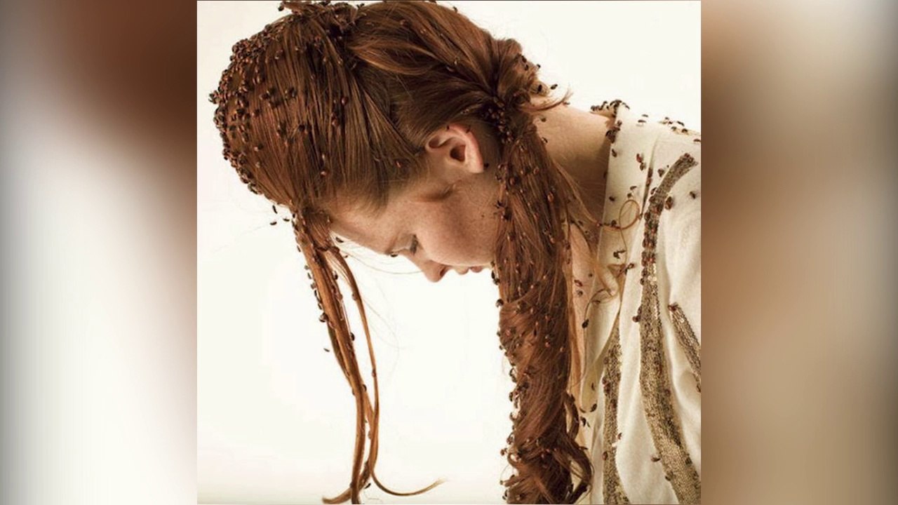 10 امراض جنسية لن تصدق انها حقيقية