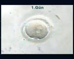 Tup Bebek Normal embriyo gelisimi.flv