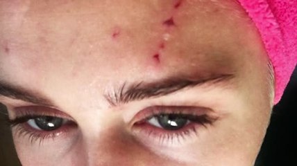 Miley Cyrus recibe arañazos duros de un gato