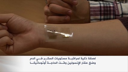 لصقة ذكية لمراقبة مستويات السكر بالدم