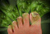 How to Get Rid of Foot Odor Fast and Naturally