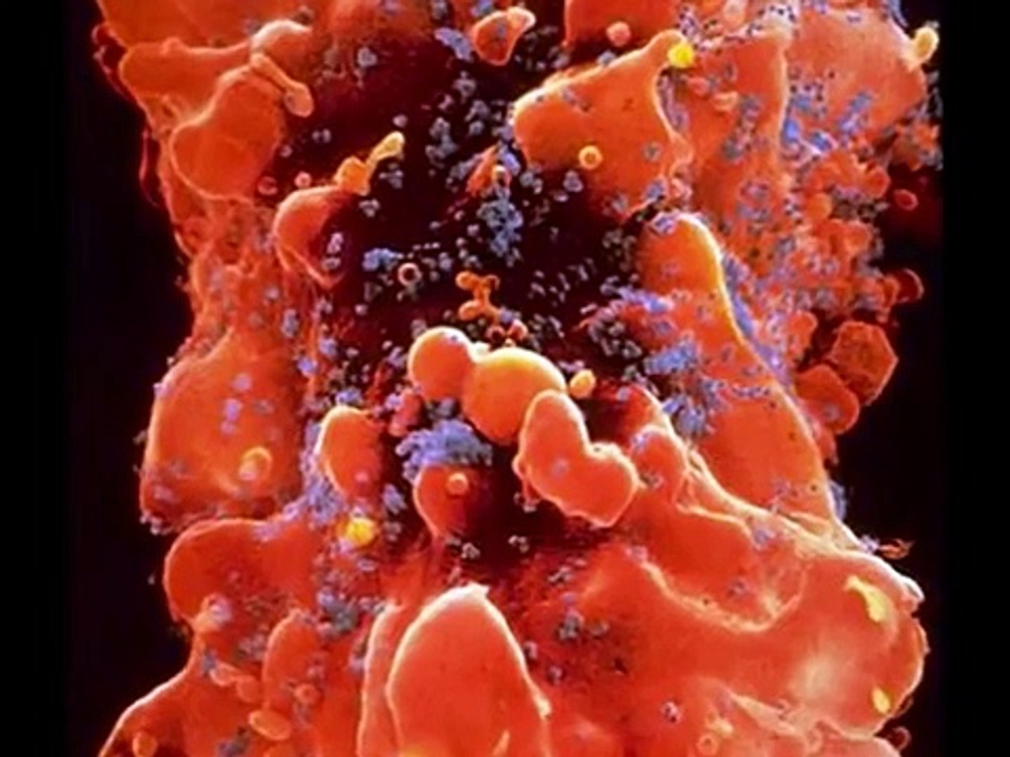 Aids Filmas 0001.wmv