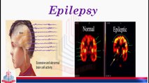 Nervous Disorders ( Epilepsy and Alzheimer's Disease  )