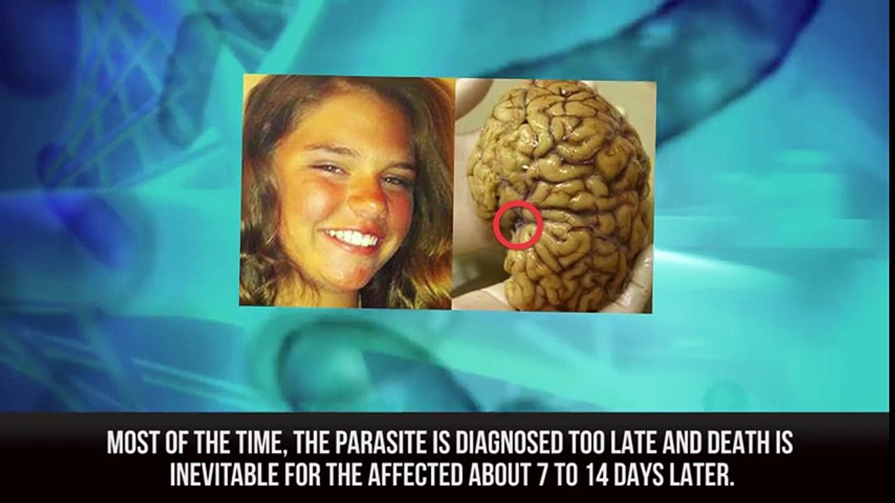 10 Tiny Creatures That Live Inside You