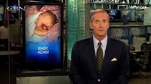 A Deformed Baby's Parents Wanted to Euthanize Him, but 2 Strangers Saved His Life