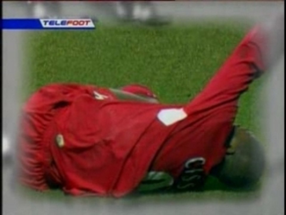 Djibril.Cisse.-.Double.fracture.