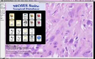 MOHS SUITE Overview - created by Norman Lockshin Ben Lockshin promoted by Mickie Johnson