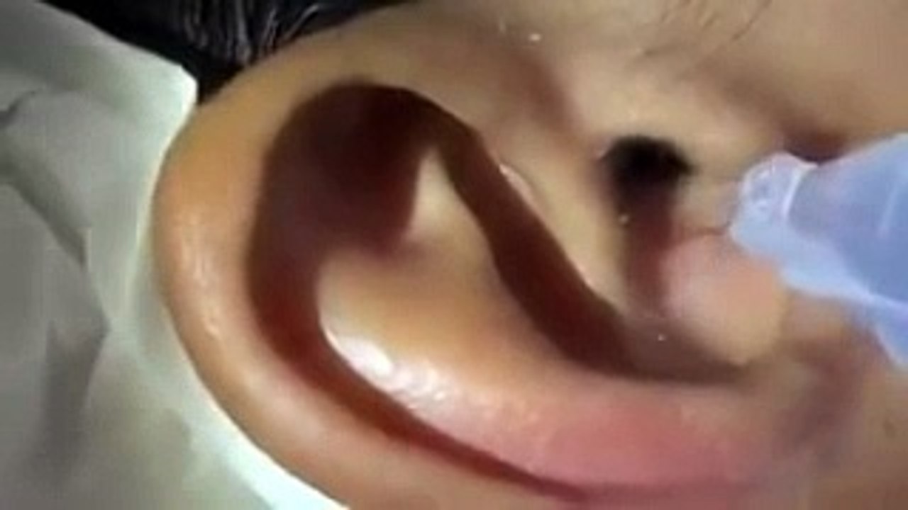 Il met des gouttes dans ses oreilles