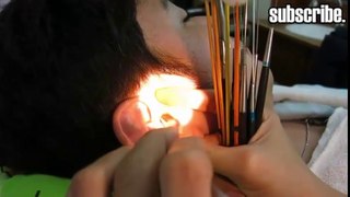ear cleaning ! how to get earwax P4