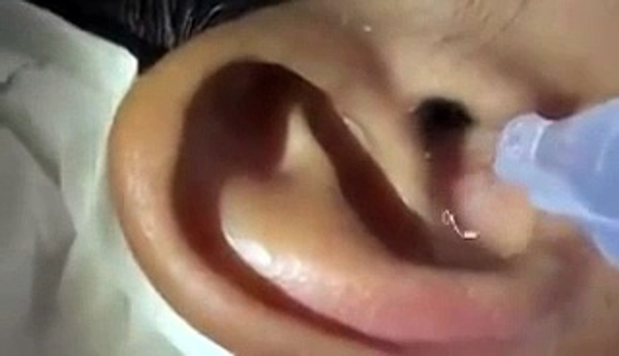 Il met des gouttes dans ses oreilles