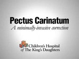 Groundbreaking surgery for pectus carinatum at CHKD