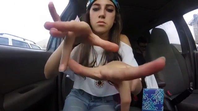 My Hand Hypermobility thanks to Ehlers-Danlos Syndrome