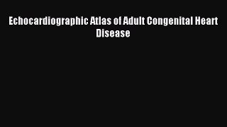 Read Echocardiographic Atlas of Adult Congenital Heart Disease Ebook Free