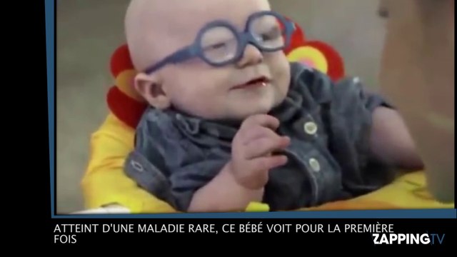 Un bébé atteint d’une maladie rare voit pour la première fois (vidéo)