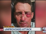 Man punched while riding bike