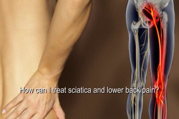 How to Treat Sciatica and Lower Back Pain