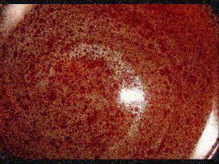 SÓLO ILUSIÓN - POEMA DE VERANO BRISAS