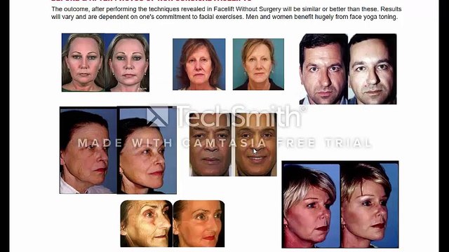 Facelift Without Surgery Review