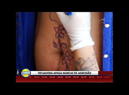 TATUADORA APAGA MARCAS DE AGRESSÃO