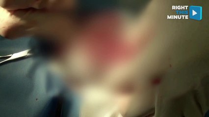 Kind Humans Rescue Bee, Puppy Has Hairball Surgically Removed From Tummy