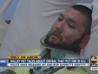 Valley veteran talks to ABC15 about ordeal that put him in ICU