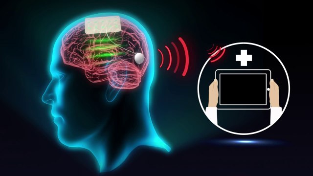 Implantes inteligentes de grafeno para tratar enfermedades