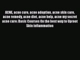 Read ACNE acne cure acne adoption acne skin care acne remedy acne diet acne help acne my secret