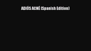 Read ADIÓS ACNÉ (Spanish Edition) Ebook Free