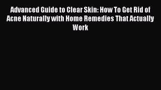 Read Advanced Guide to Clear Skin: How To Get Rid of Acne Naturally with Home Remedies That