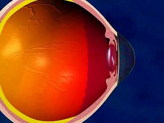 Lasik (blade) Surgery Procedure - Asian Eye Hospital