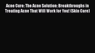 [Read book] Acne Cure: The Acne Solution: Breakthroughs in Treating Acne That Will Work for