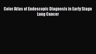 Read Color Atlas of Endoscopic Diagnosis in Early Stage Lung Cancer Ebook Free