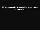 Download MRI of Degenerative Disease of the Spine: A Case-Based Atlas  Read Online