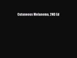 Read Cutaneous Melanoma 2ND Ed Ebook Free