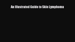 Read An Illustrated Guide to Skin Lymphoma Ebook Free
