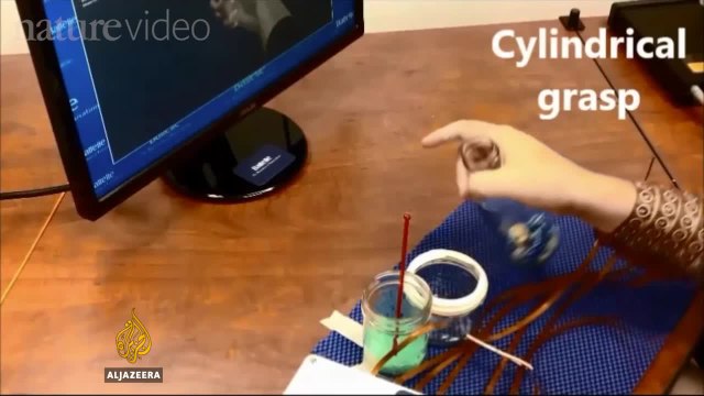 Medical wonder: Paralysed man moves with technology