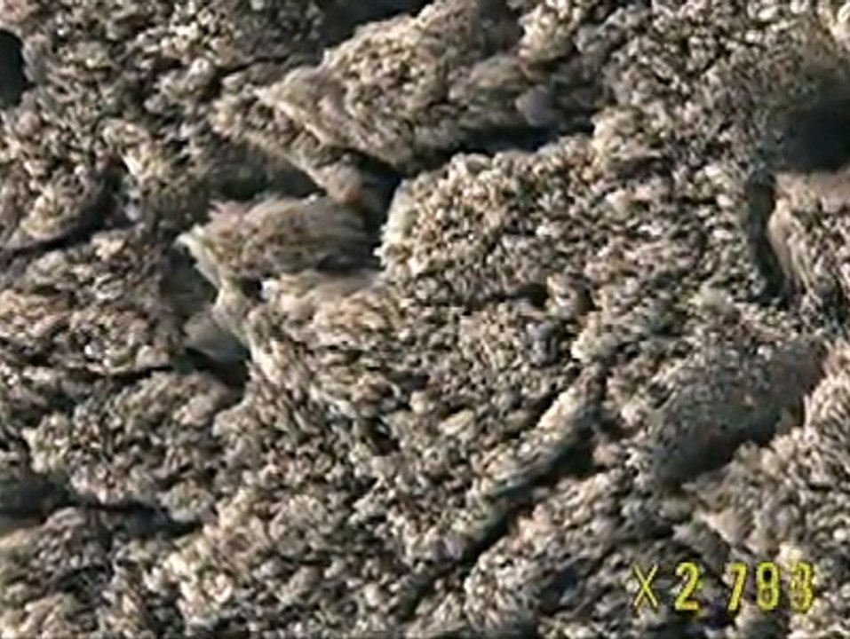 Zoom into a Tooth