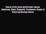 Read Cancer of the Colon and Rectum: Causes Symptoms Signs Diagnosis Treatments Stages of Colon