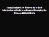 Read ‪Lupus Handbook for Women: Up-to-Date Information on Understanding and Managing the Disease‬