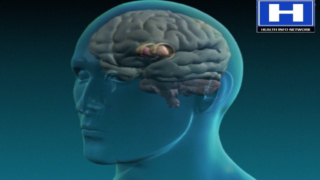 Athetosis symptoms, causes, pharmacology, treatment