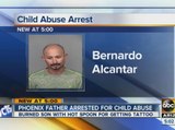 Phoenix father arrested for child abuse