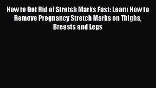 Download How to Get Rid of Stretch Marks Fast: Learn How to Remove Pregnancy Stretch Marks
