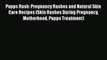 PDF Pupps Rash: Pregnancy Rashes and Natural Skin Care Recipes (Skin Rashes During Pregnancy