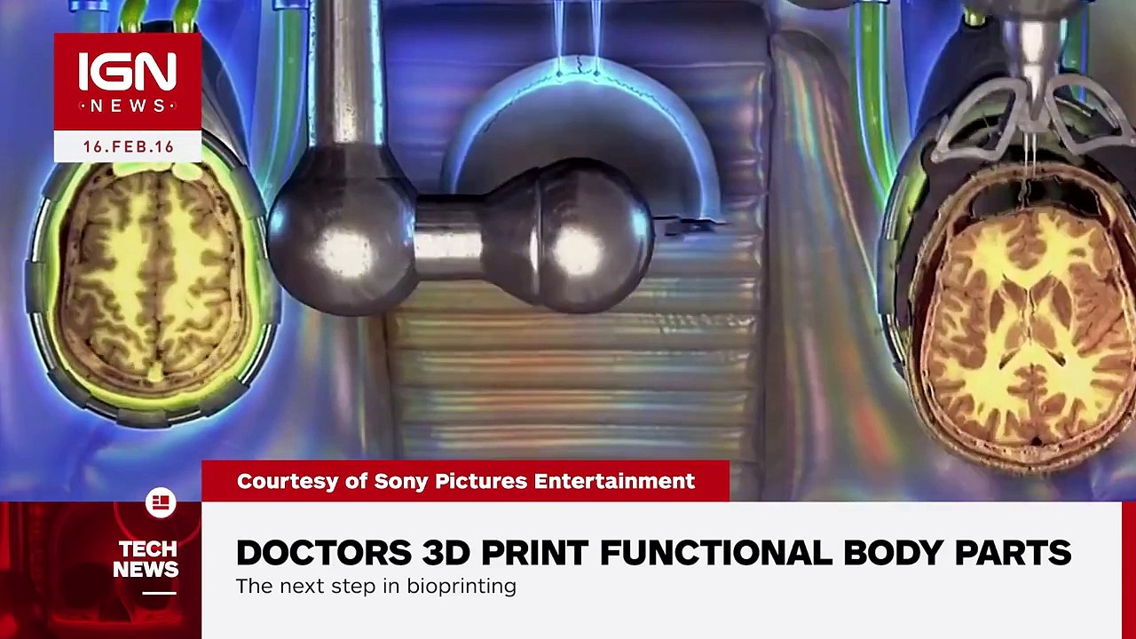 Doctors 3D Print Functional Body Parts IGN News