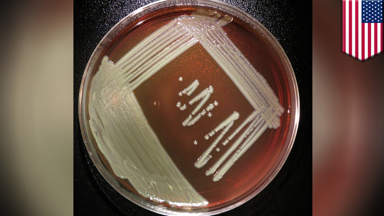 Mysterious Elizabethkingia bacteria claims 20 lives in multistate outbreak