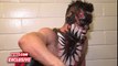 Finn Bálor feels the effects of his battle with Samoa Joe  April 1, 2016