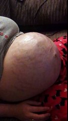 Dad Captures Baby’s Legs Poking Out Of Mom’s Baby Bump