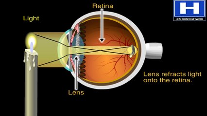 How the Eye Works Animation - How Do We See Video - Nearsighted & Farsighted Human Eye Anatomy